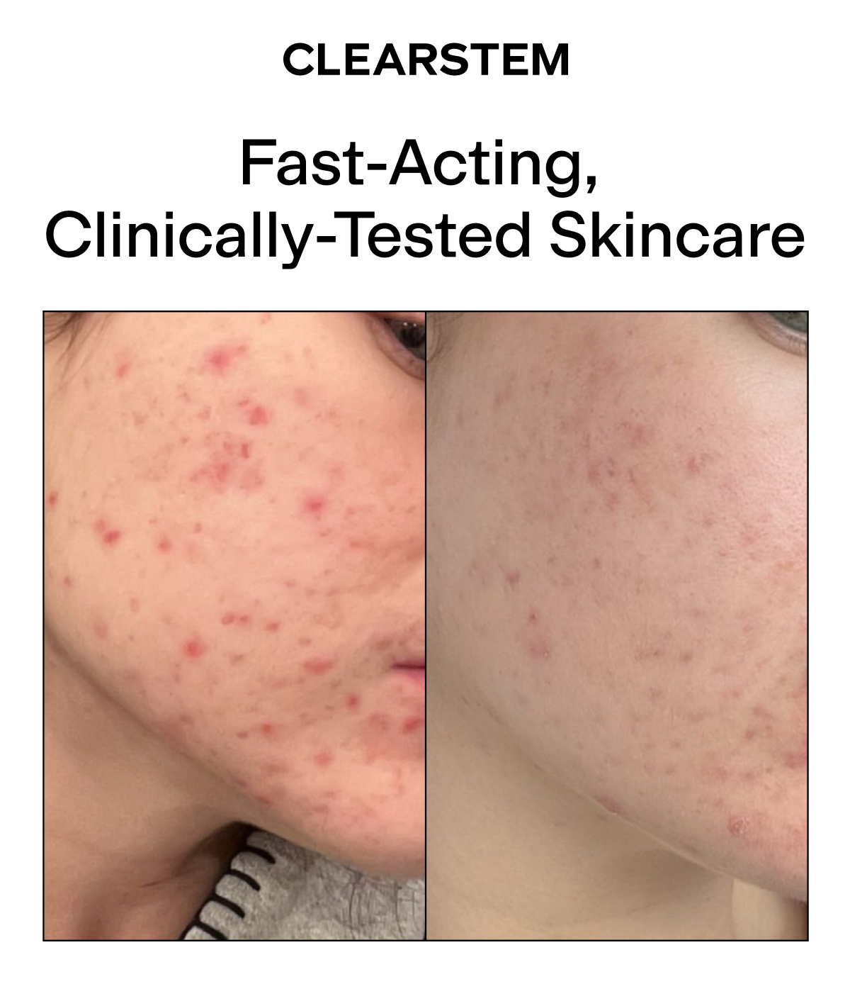 Fast Acting Clinically Tested Skincare