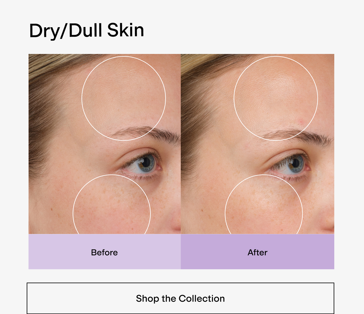 Dry/Dull Skin