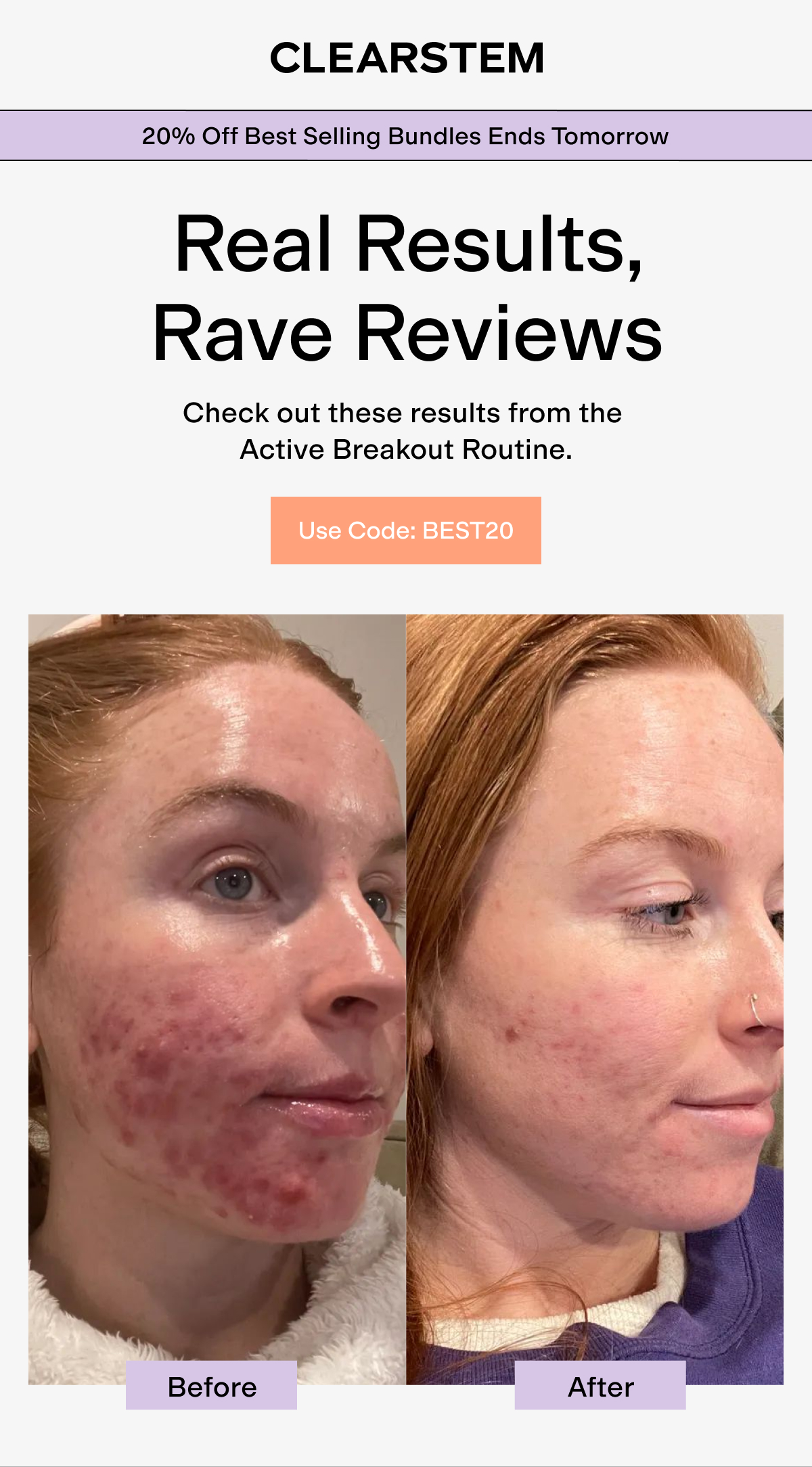 20% Off Best Selling Bundles