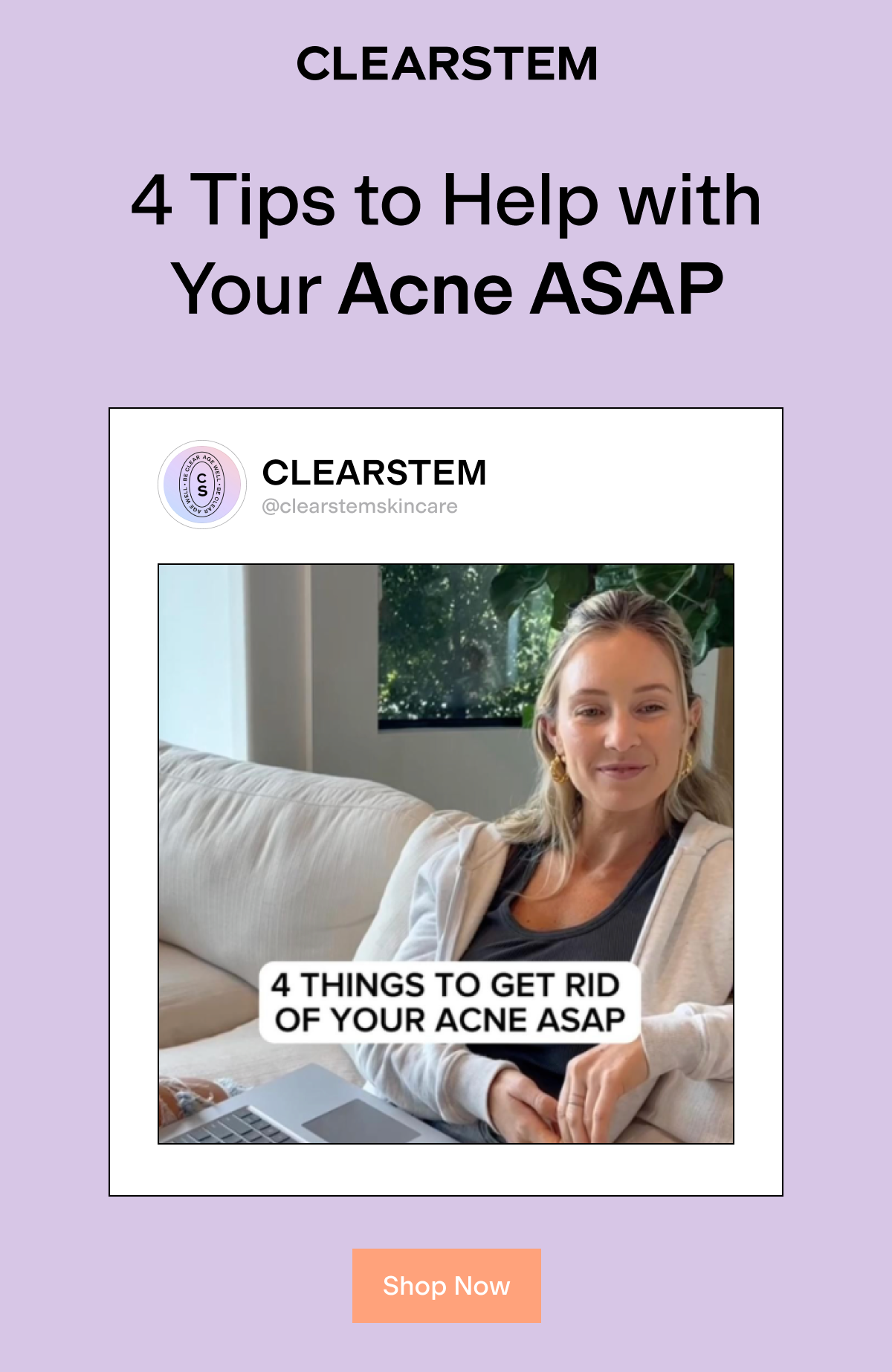4 tips to help with acne asap