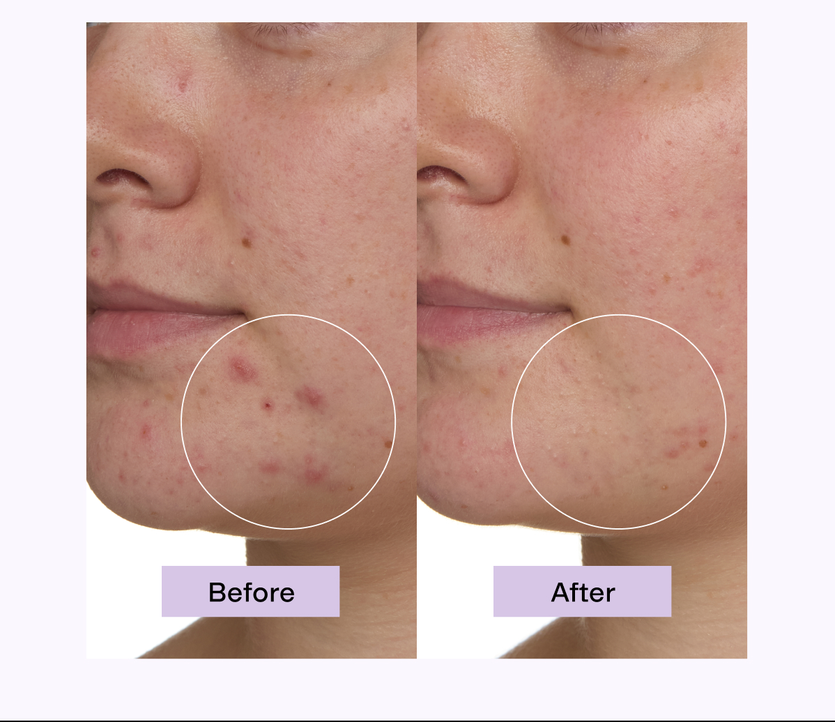 Before + After