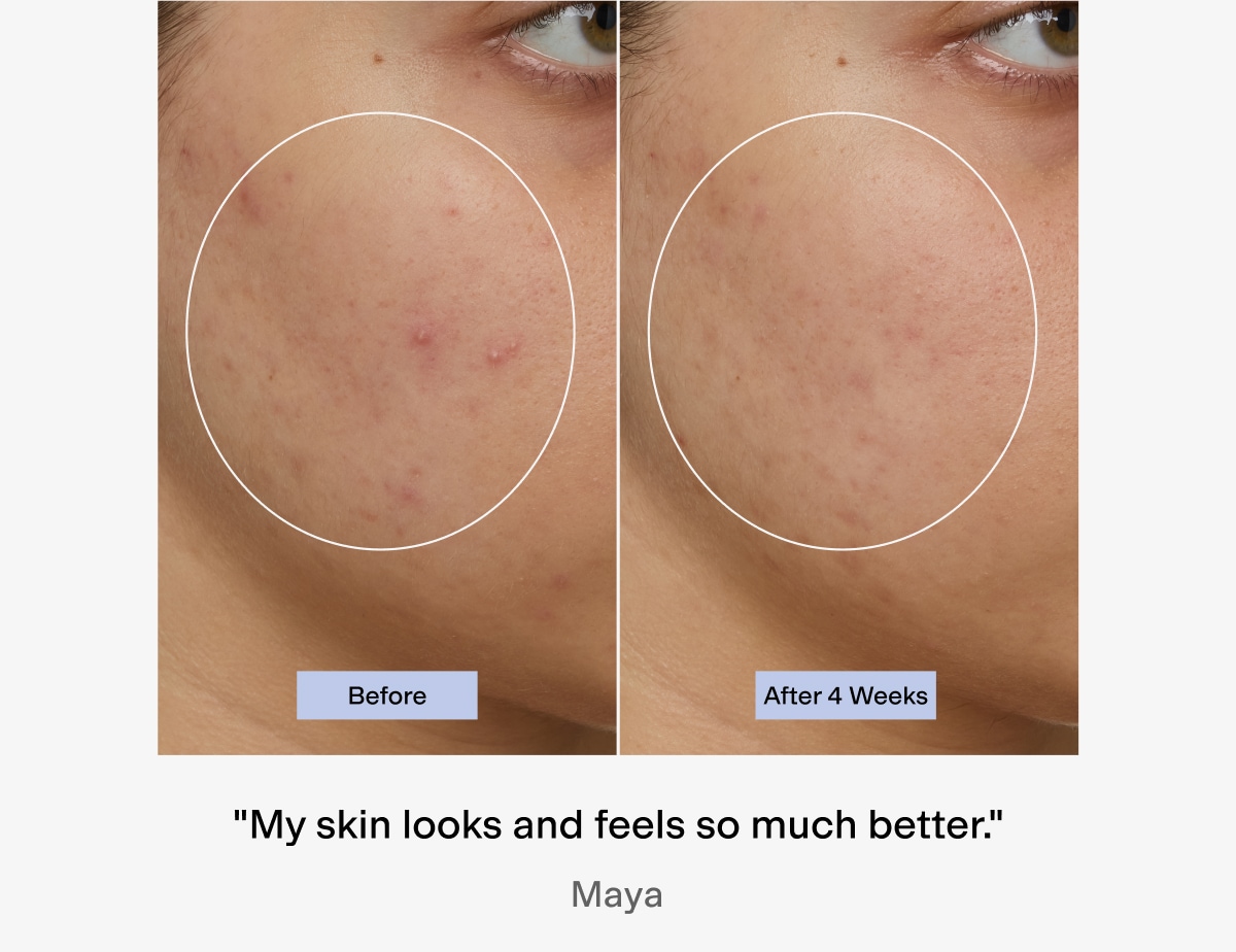"My skin looks and feels so much better"