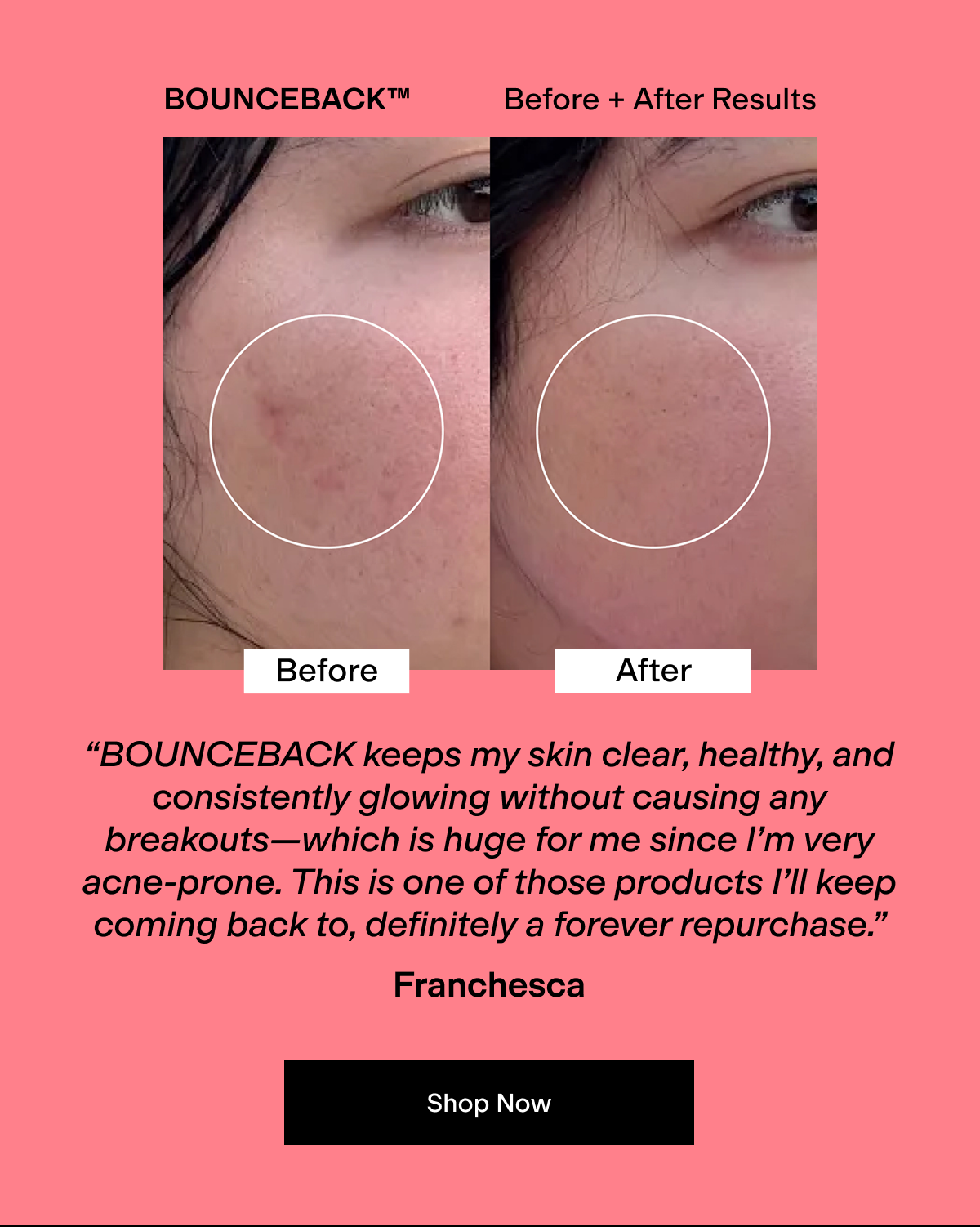 Before + After