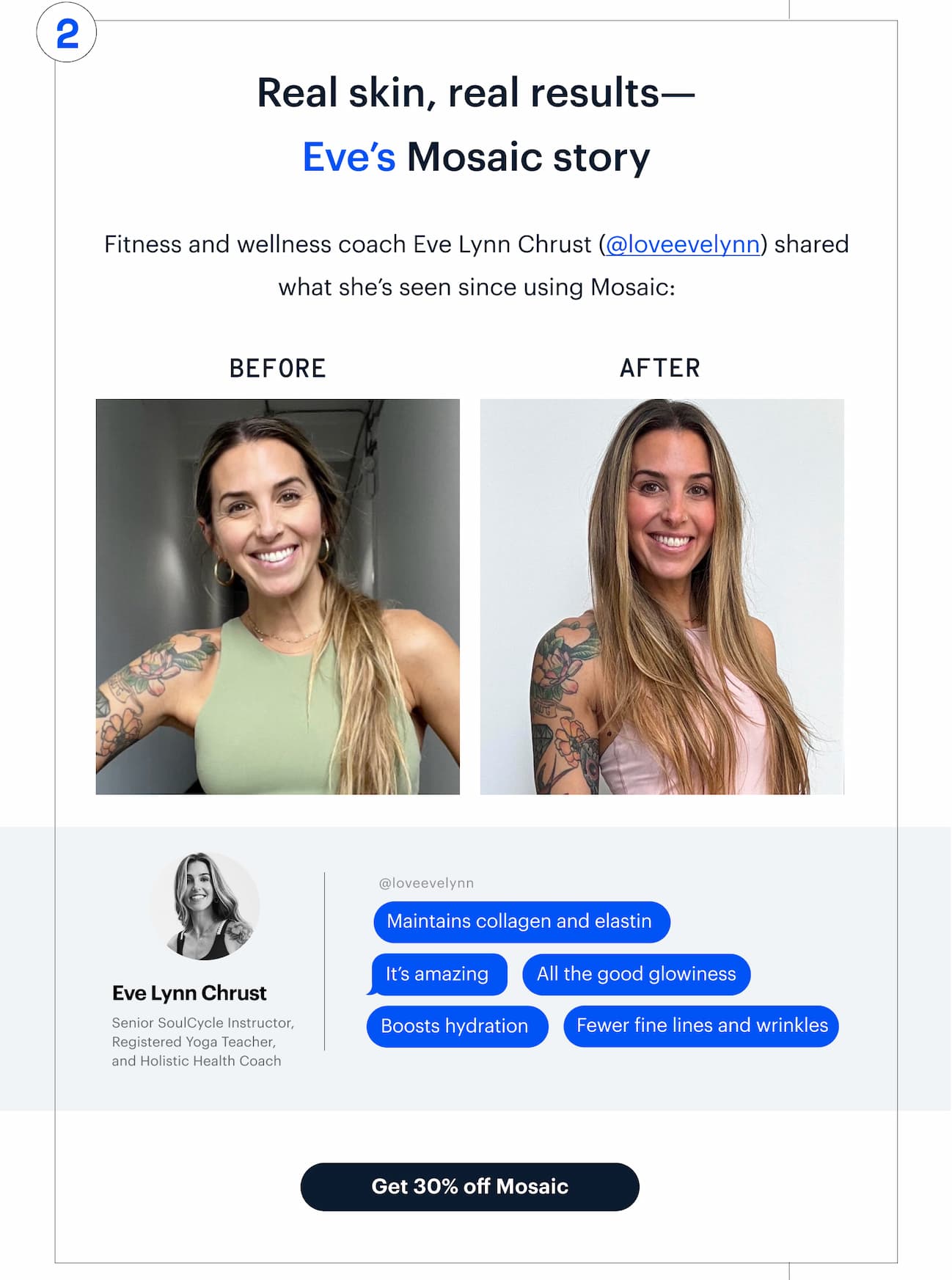2 | Real skin, real results—Eve’s Mosaic story | Get 30% off Mosaic
