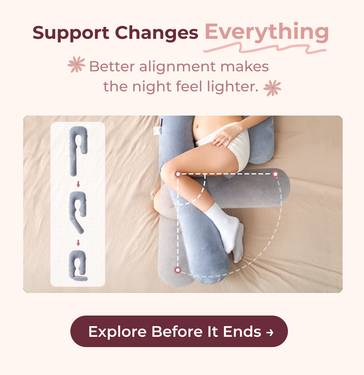 Support Changes Everything