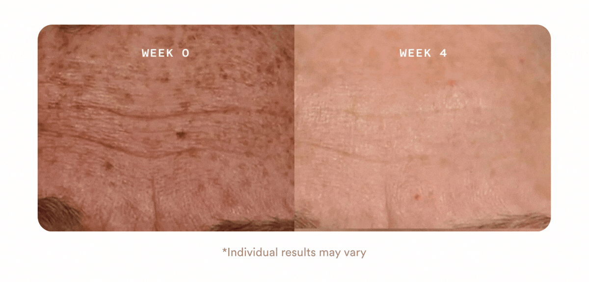 smooth skin you can see in 1 month