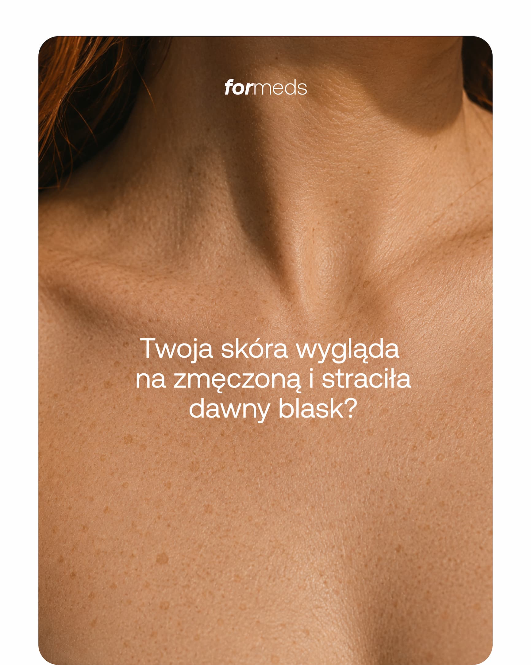 formeds Twoja skóra wygląda na zmęczoną i straciła dawny blask?