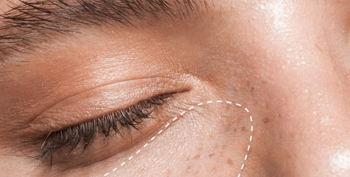 Smarter Skincare  Starts with a Scan GLOV AI Face Scan:  Your Free, Personalized Beauty Snalysis