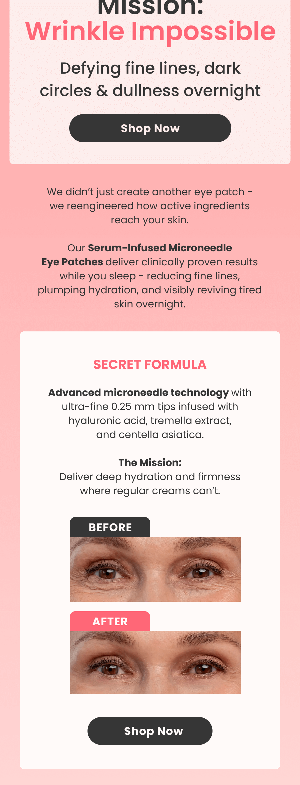 SECRET FORMULA Advanced microneedle technology with ultra-fine 0.25 mm tips infused with hyaluronic acid, tremella extract, and centella asiatica.  The Mission: Deliver deep hydration and firmness where regular creams can't.