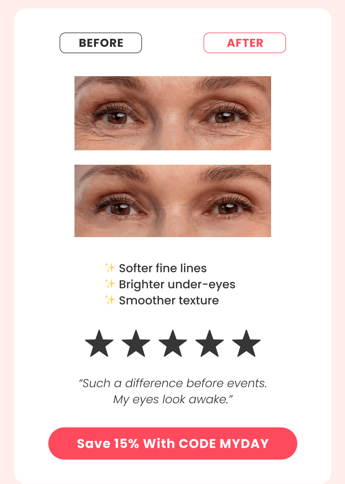 Micro-Infusion System Your at-home facial that boosts collagen and reveals younger-looking skin.