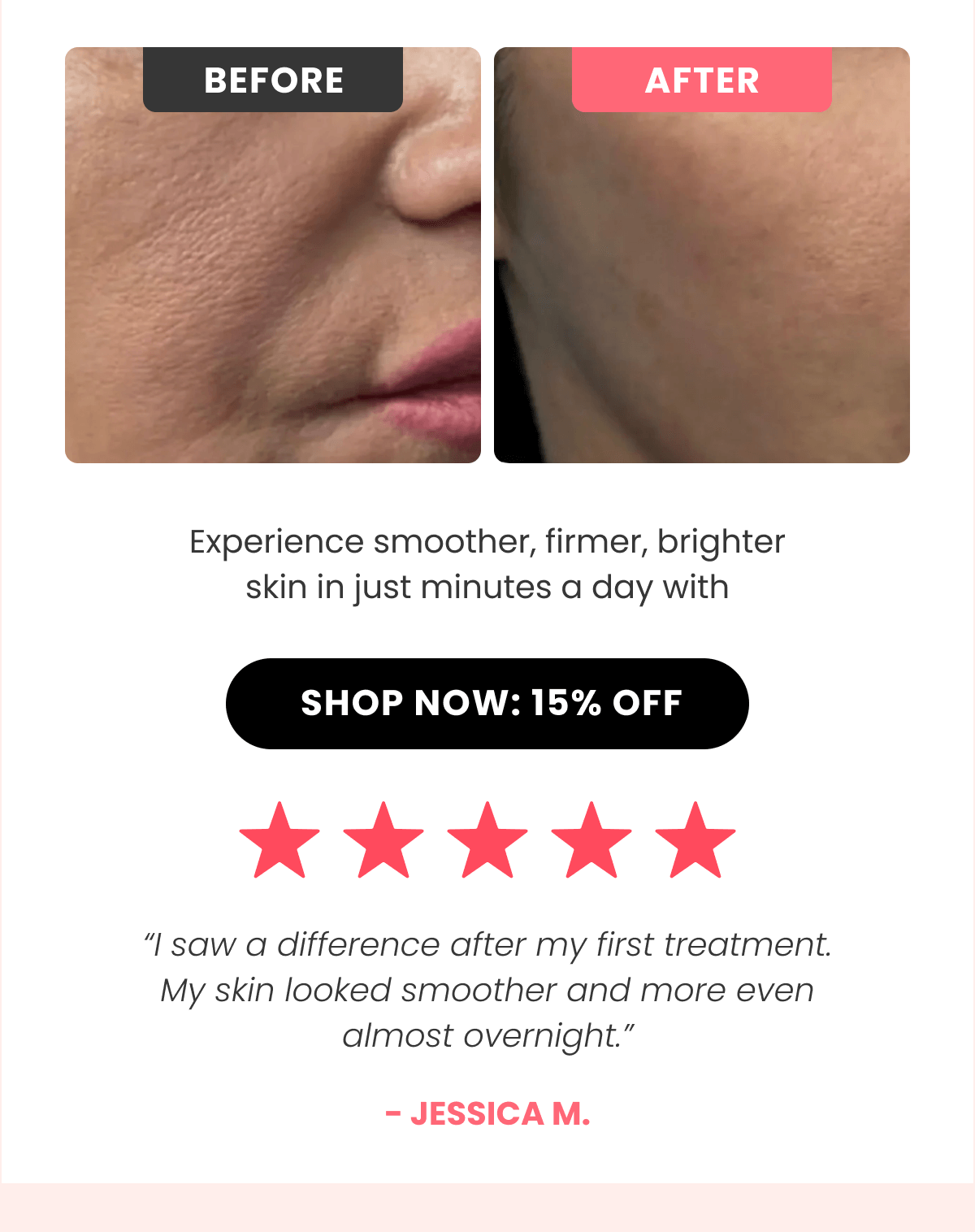 Micro-Infusion System Your at-home facial that boosts collagen and reveals younger-looking skin.