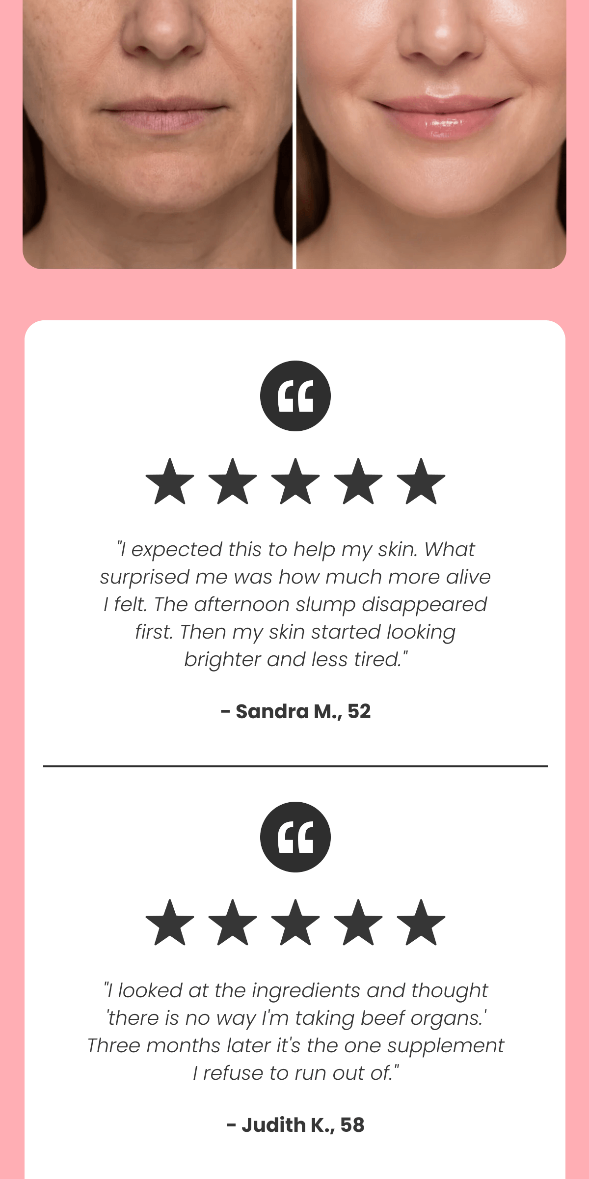 "I expected this to help my skin. What surprised me was how much more alive I felt. The afternoon slump disappeared first. Then my skin started looking brighter and less tired." - Sandra M., 52
