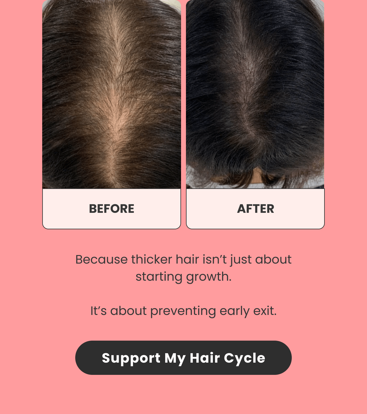 Because thicker hair isn't just about starting growth.  It's about preventing early exit.