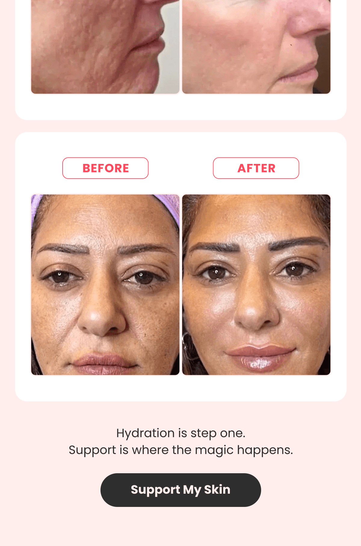Hydration is step one. Support is where the magic happens.