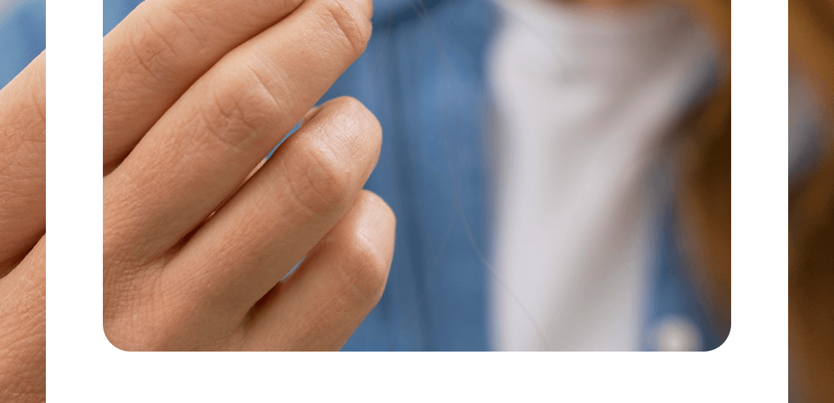 Hair loss is not ‘just aging’… And it's definitely not something you should ignore!