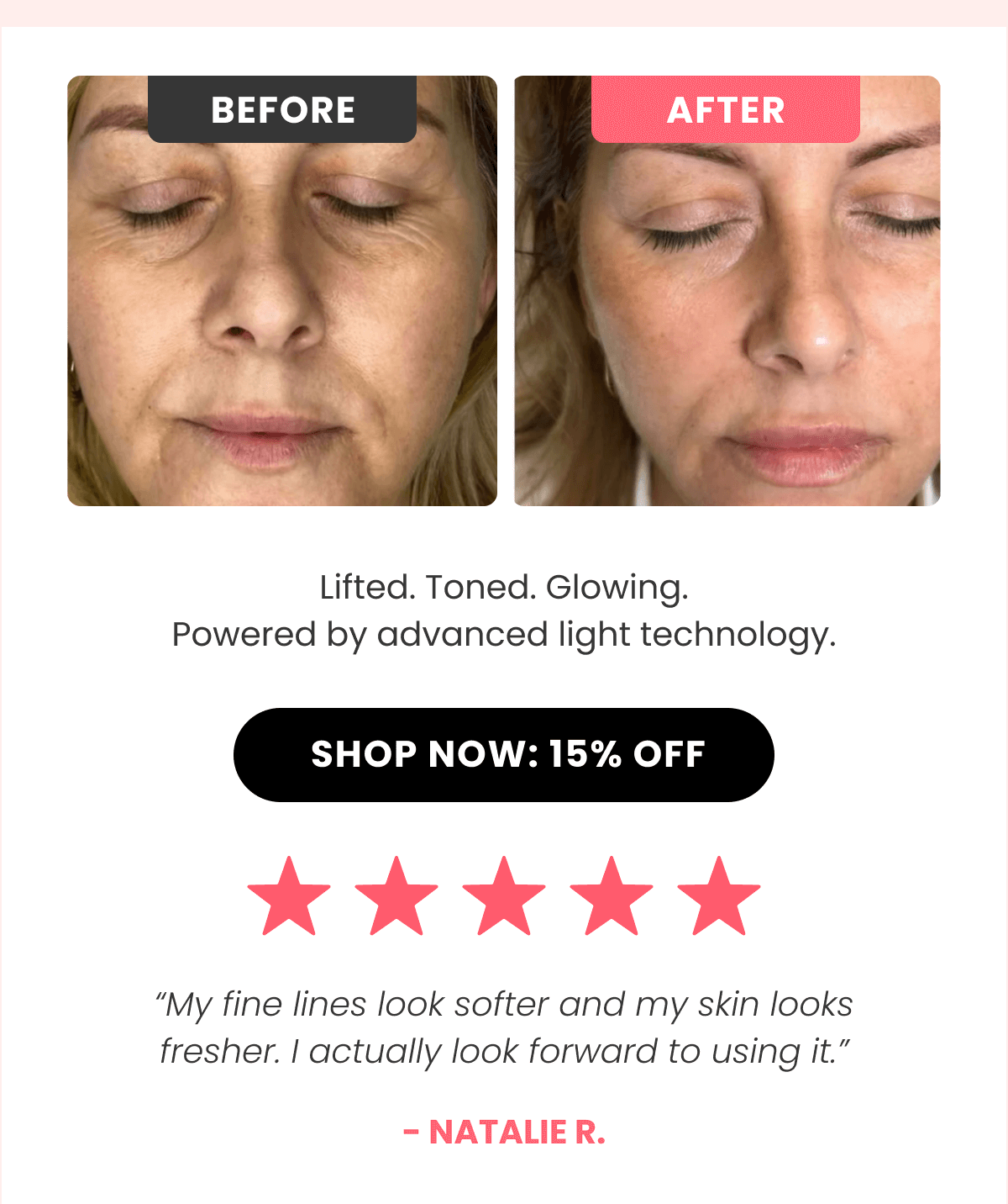 Micro-Infusion System Your at-home facial that boosts collagen and reveals younger-looking skin.