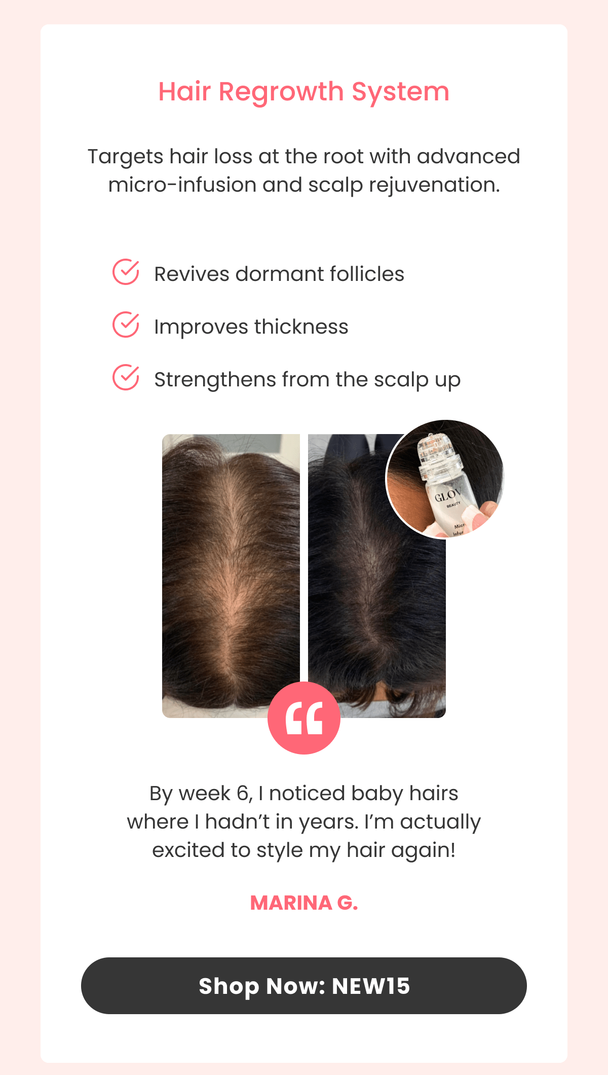 Hair Regrowth System Advanced micro-infusion tech for real follicle renewal.