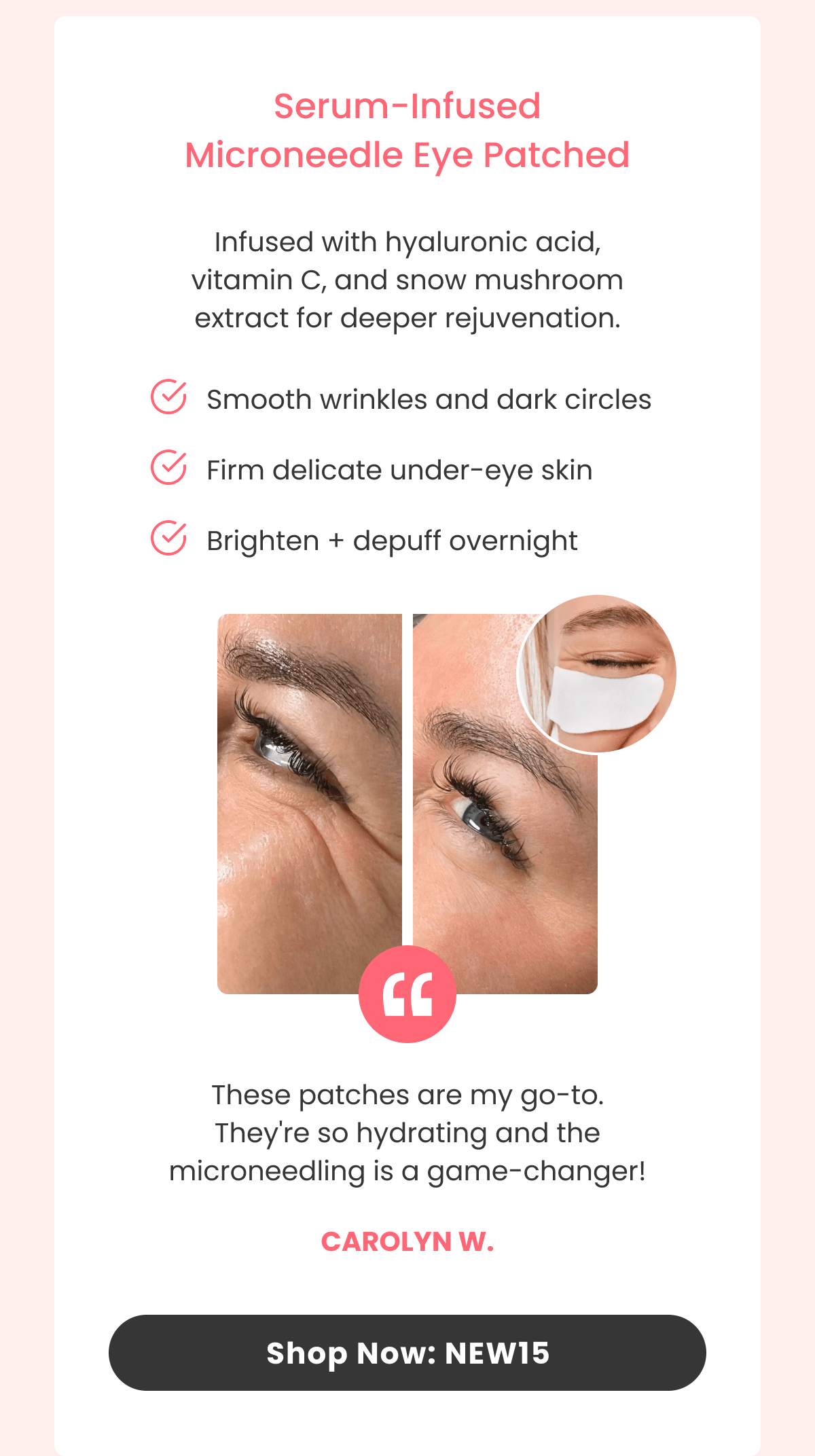 Hair Regrowth System Advanced micro-infusion tech for real follicle renewal.