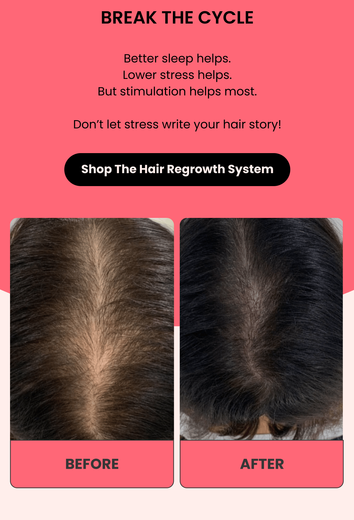 BREAK THE CYCLE Better sleep helps. Lower stress helps. But stimulation helps most.  Don't let stress write your hair story!