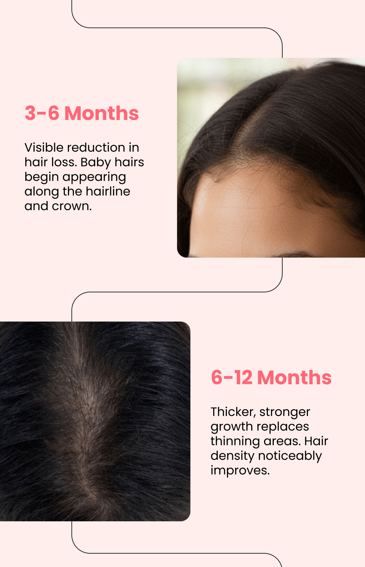 Hair Regrowth System Advanced micro-infusion tech for real follicle renewal.