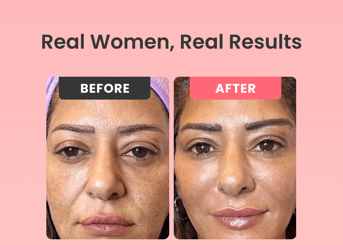 Hair Regrowth System Advanced micro-infusion tech for real follicle renewal.