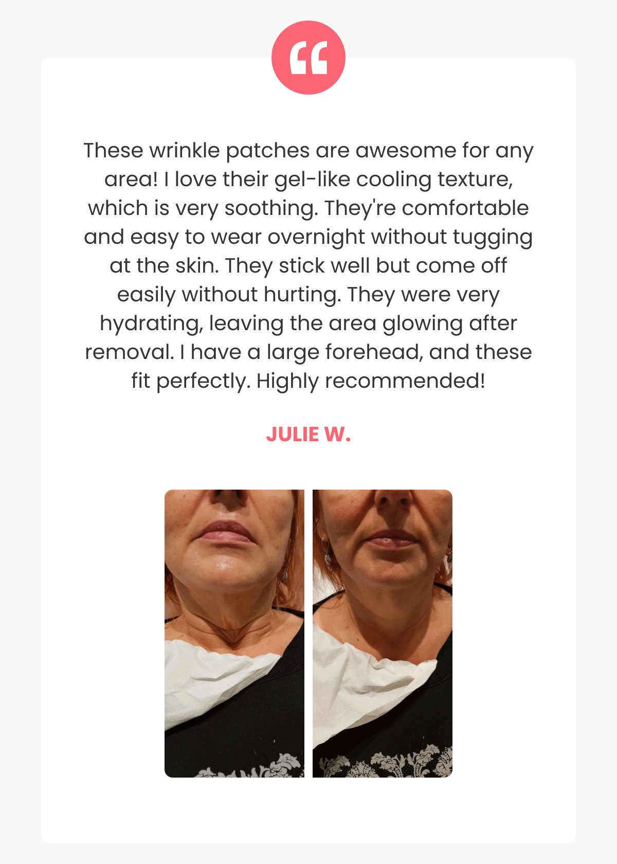 My scalp feels healthier, my hair's thicker, and I'm confident again. Olivia G.