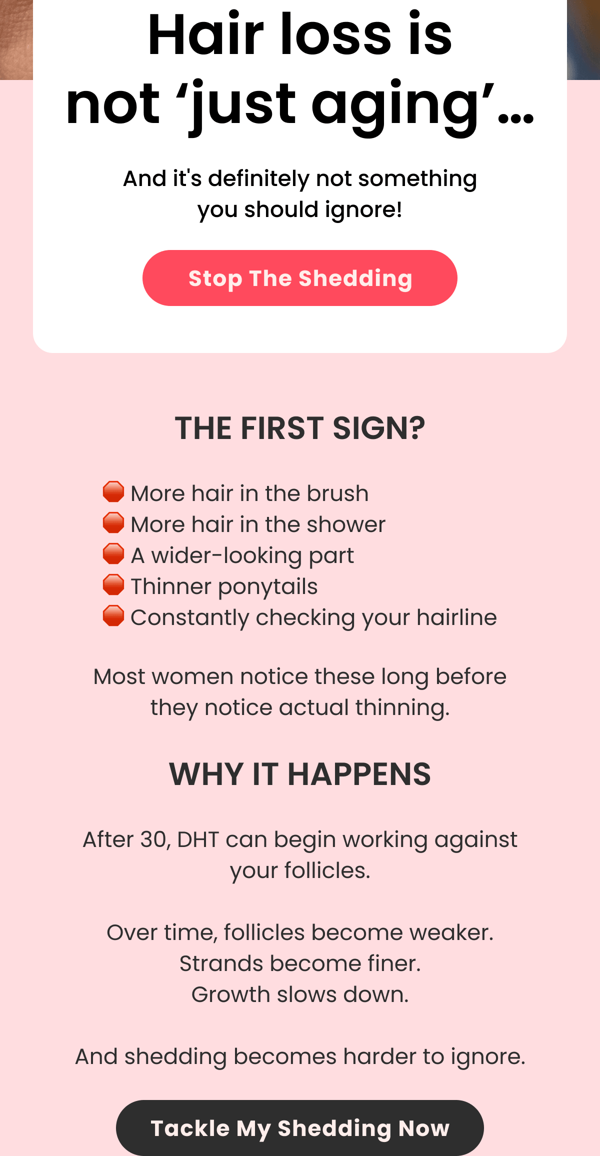 Hair loss is not ‘just aging’… And it's definitely not something you should ignore!