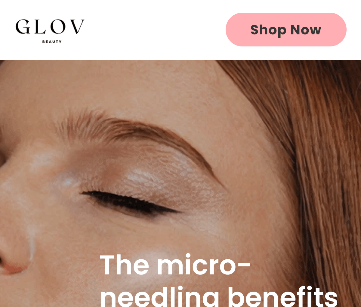 The micro-needling benefits you'll wish you knew sooner
