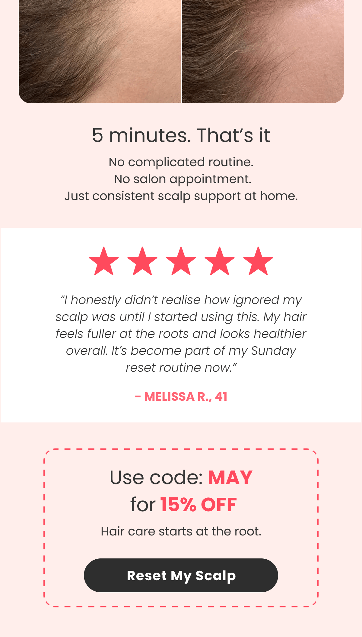 5 minutes. That’s it No complicated routine.  No salon appointment. Just consistent scalp support at home.