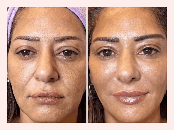 The mask that broke the internet  (and your fine lines!) last year (still stealing the spotlight in 2026)