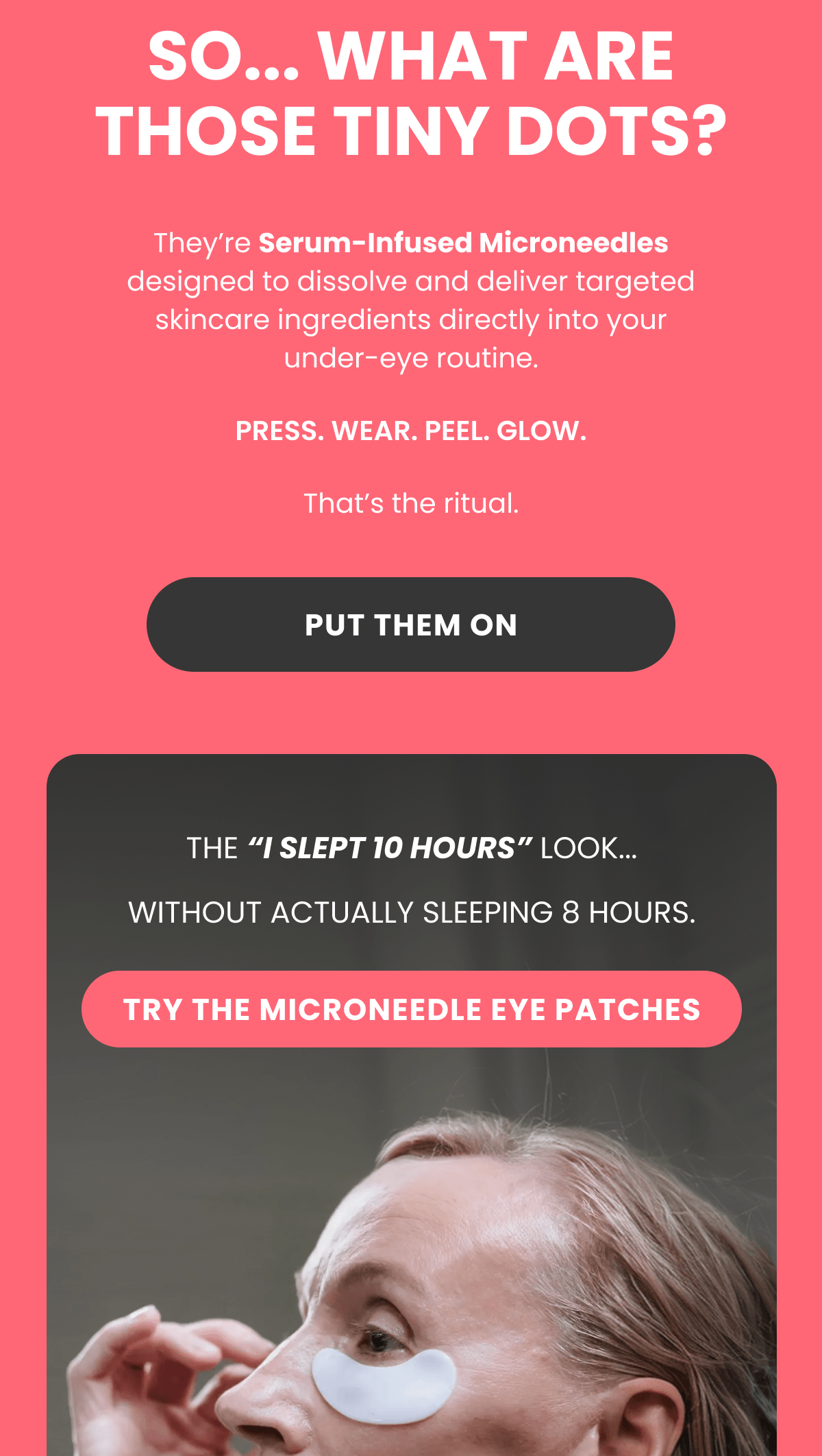 SO... WHAT ARE THOSE TINY DOTS?