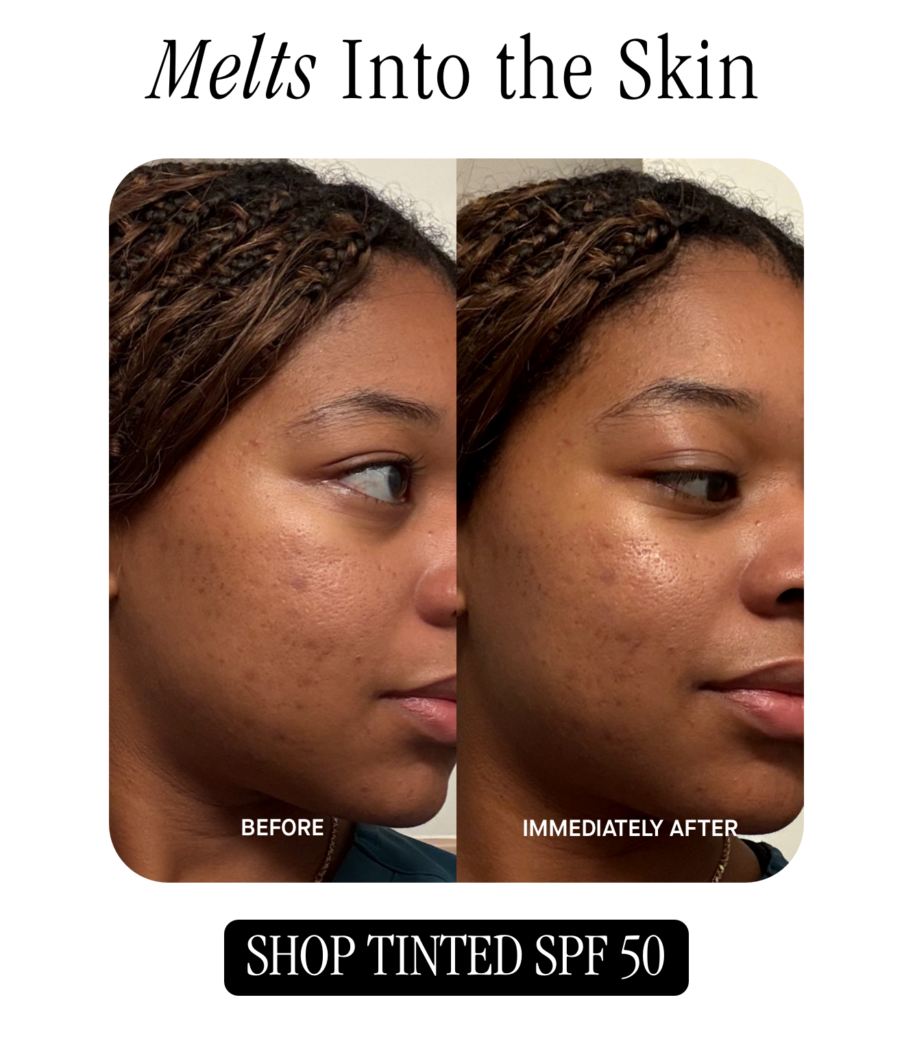 Melts Into the Skin