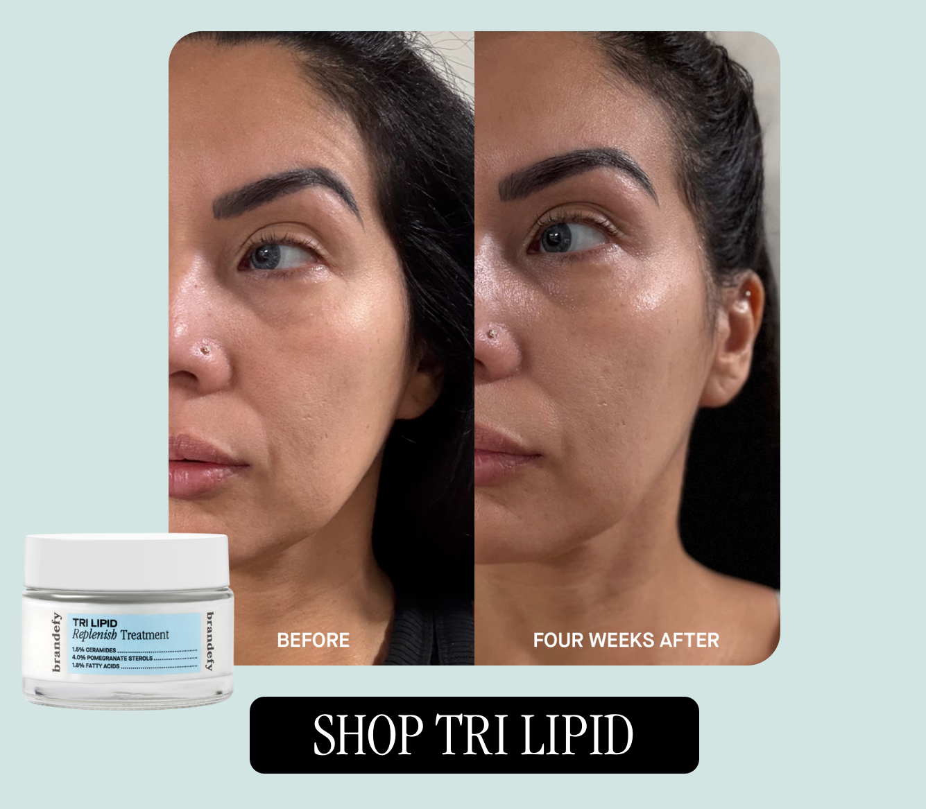 Tri Lipid Replenish Treatment