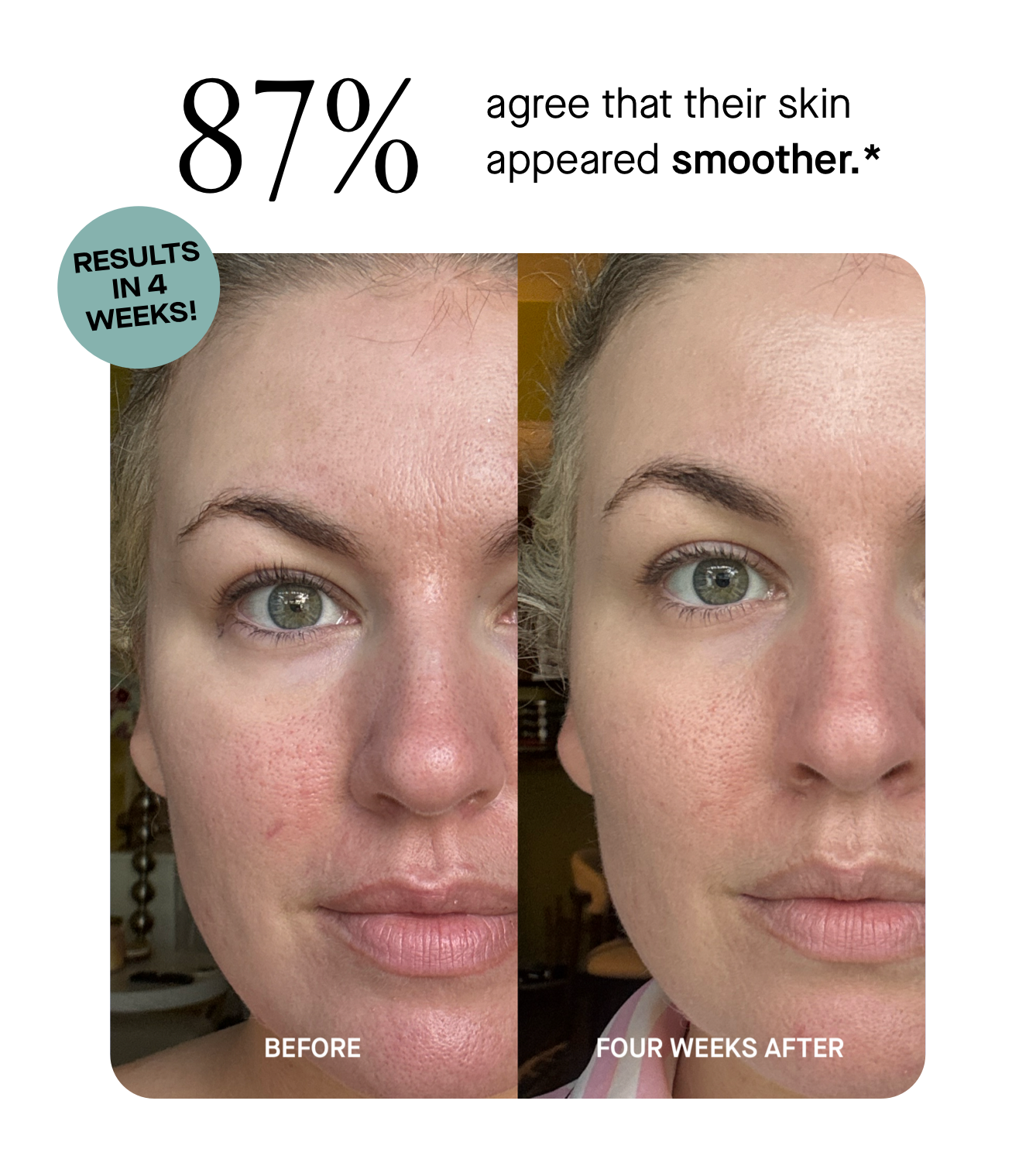 87% agree that their skin appeared smoother.*