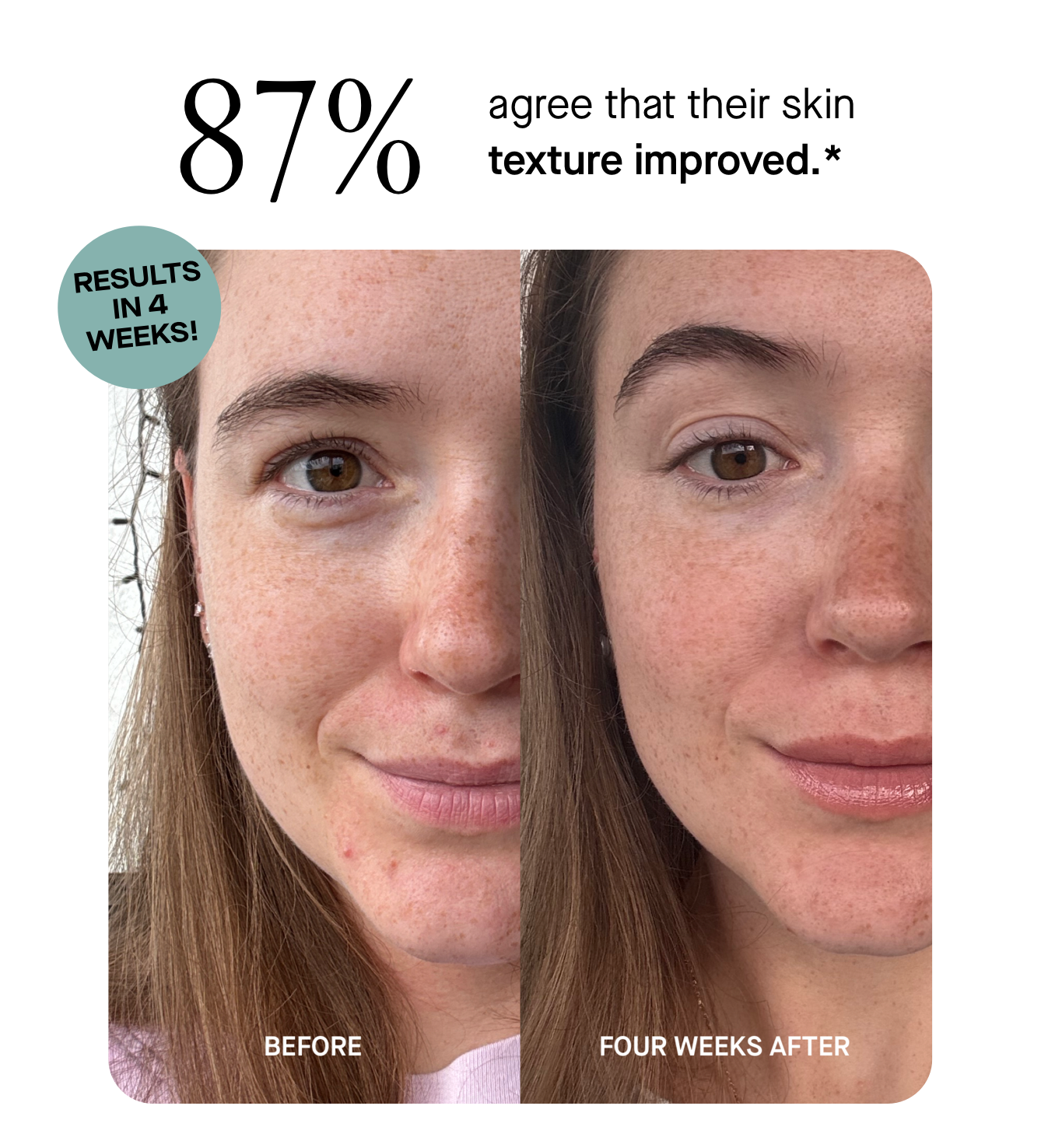 87% agree that their skin texture improved.*