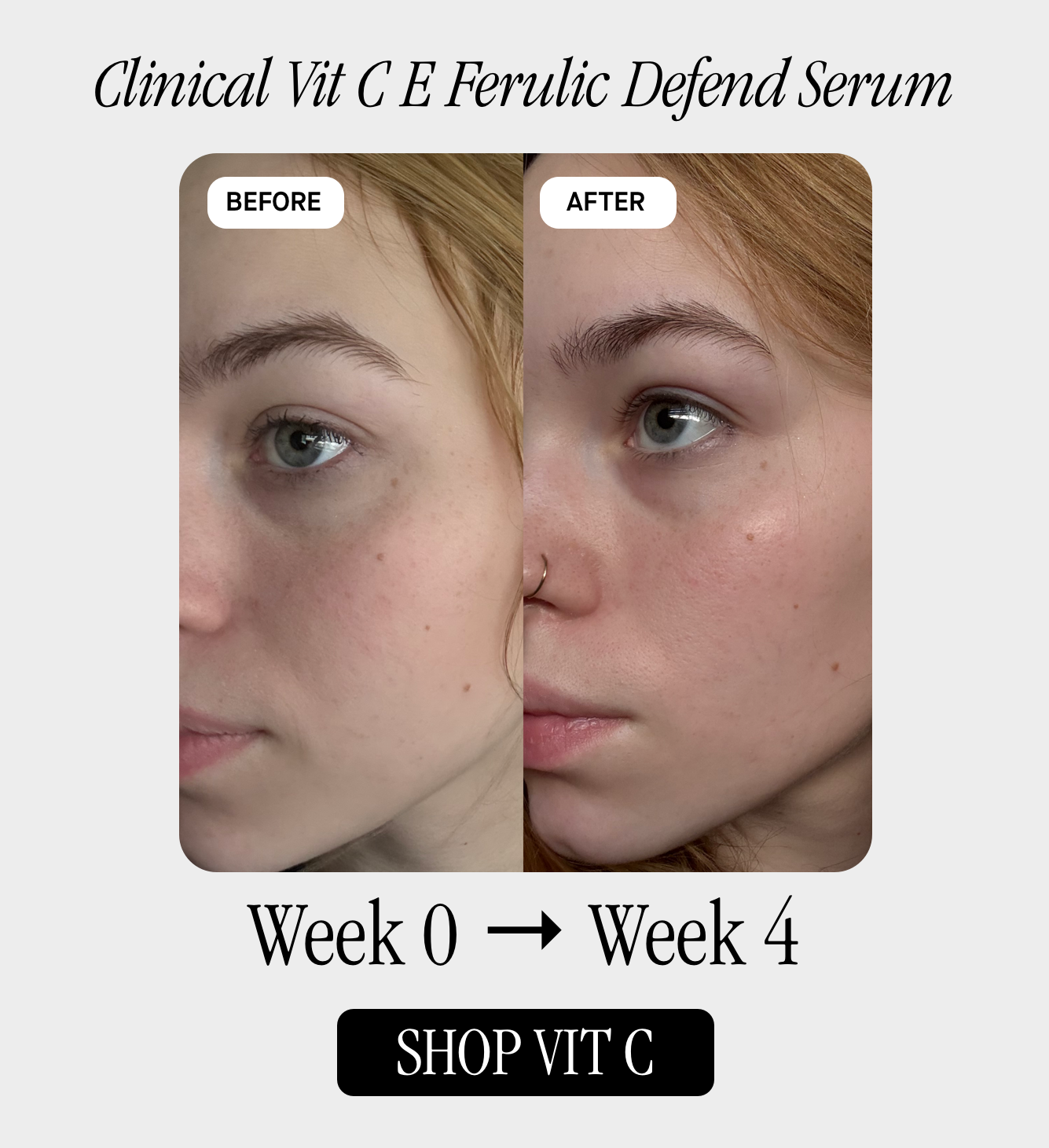 Clinical Vit C + E + Ferulic Defend Serum