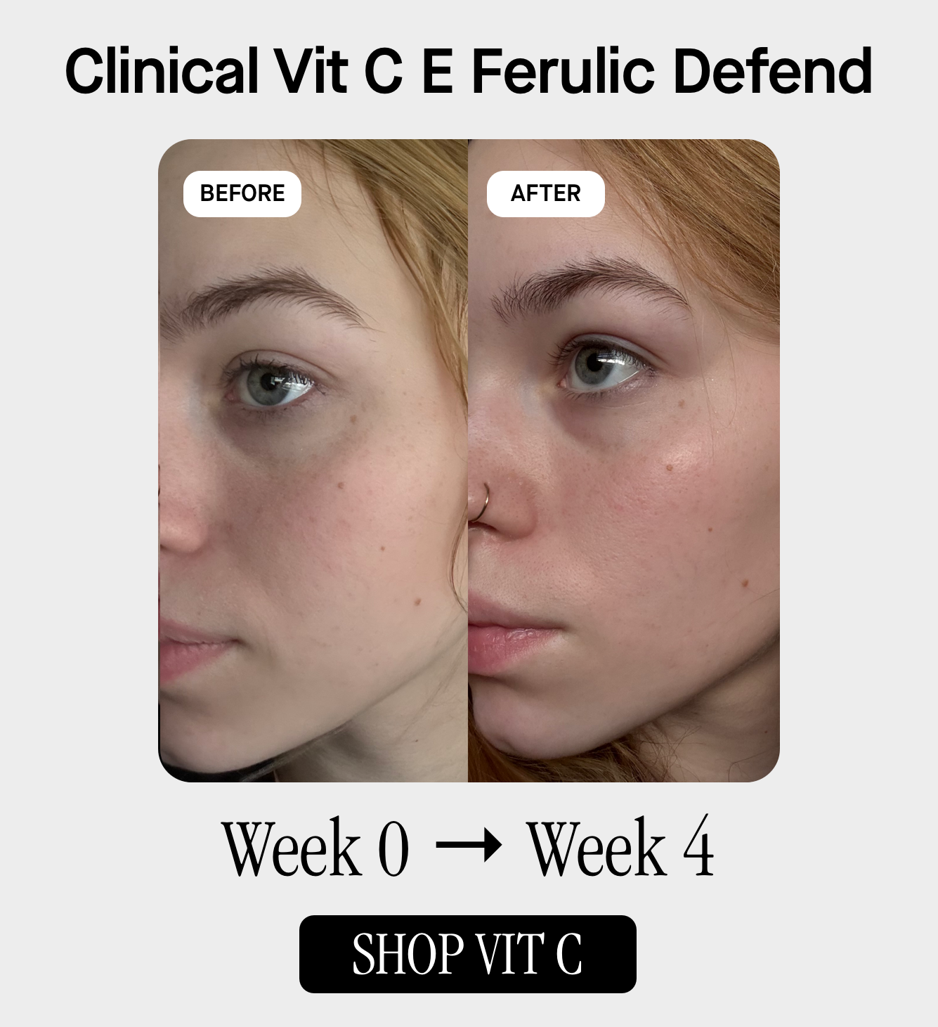 Clinical VIT C + E + FERULIC DEFEND