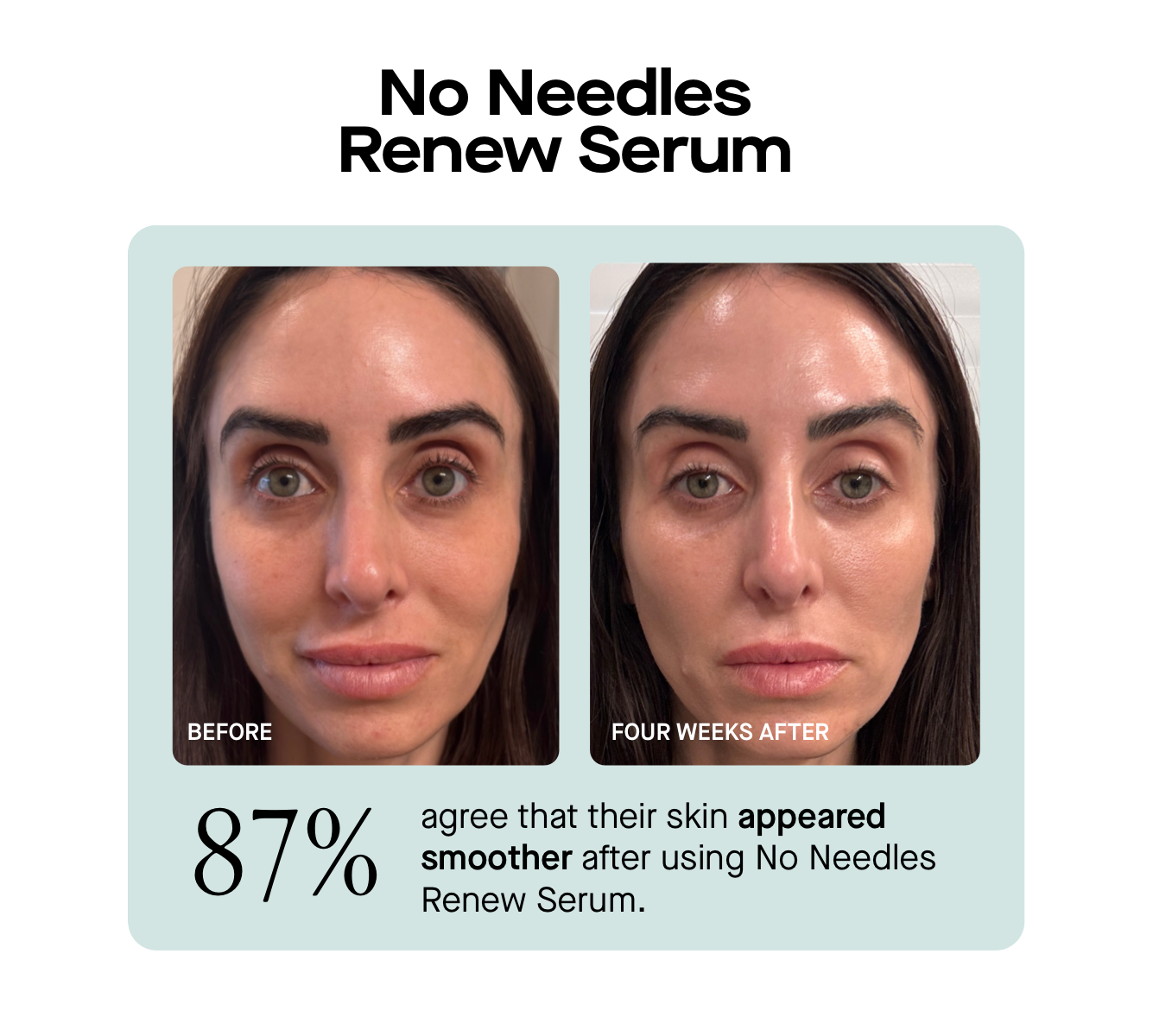 No Needles Renew Serum