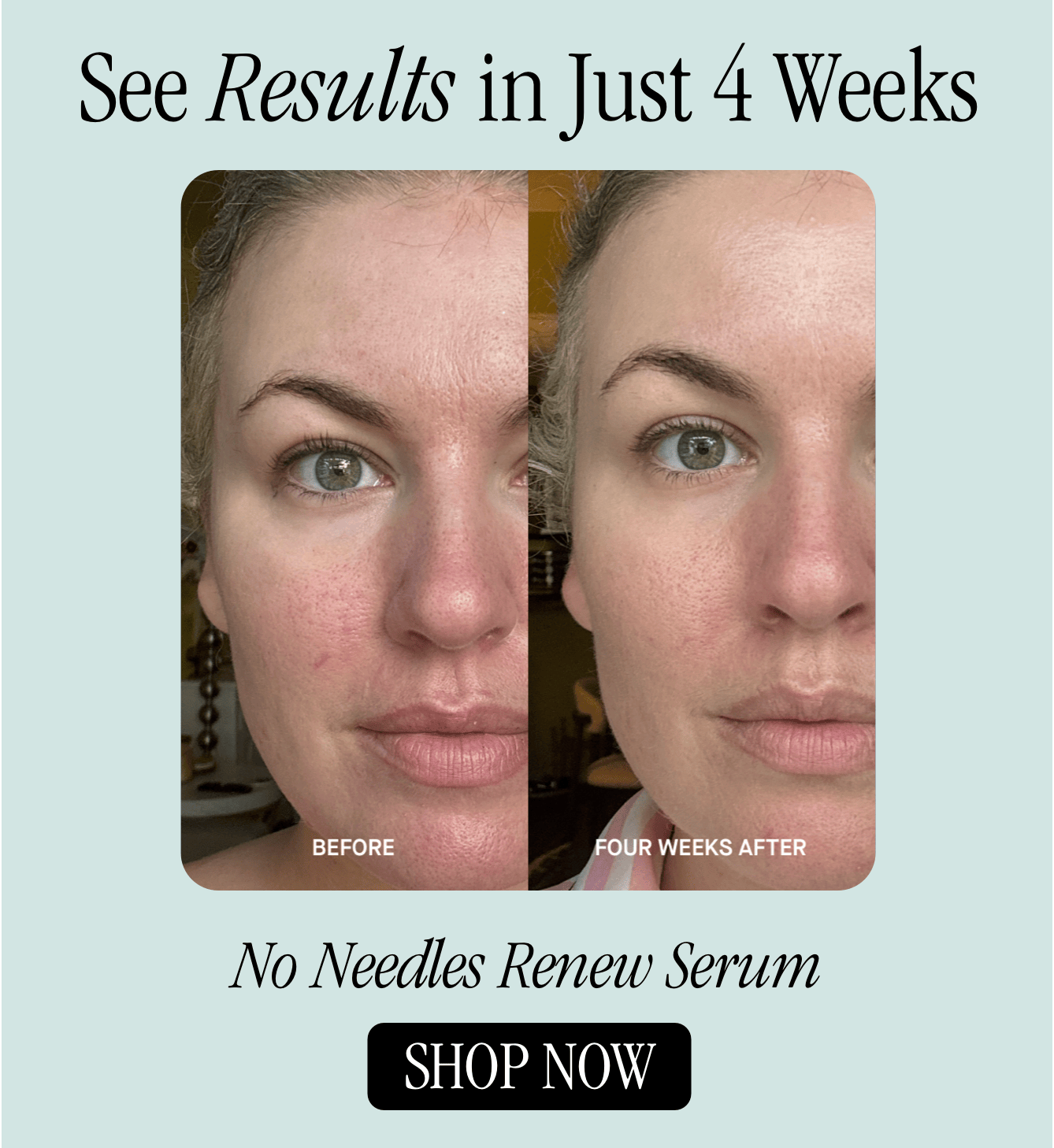 See Results in Just 4 Weeks