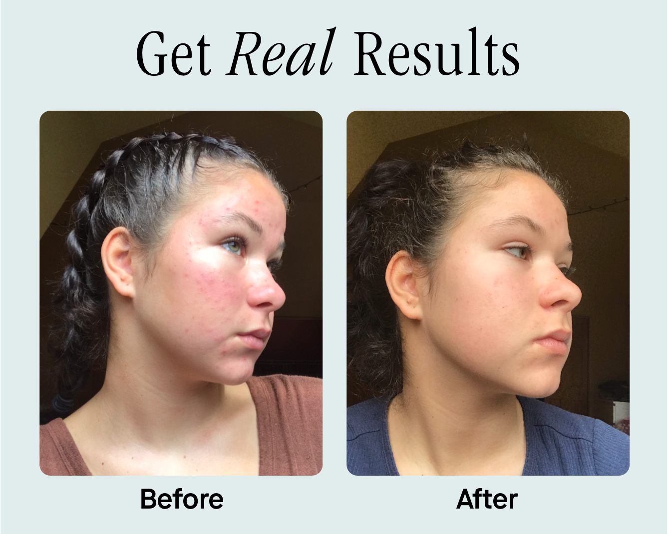 Get Real Results Get Real Results