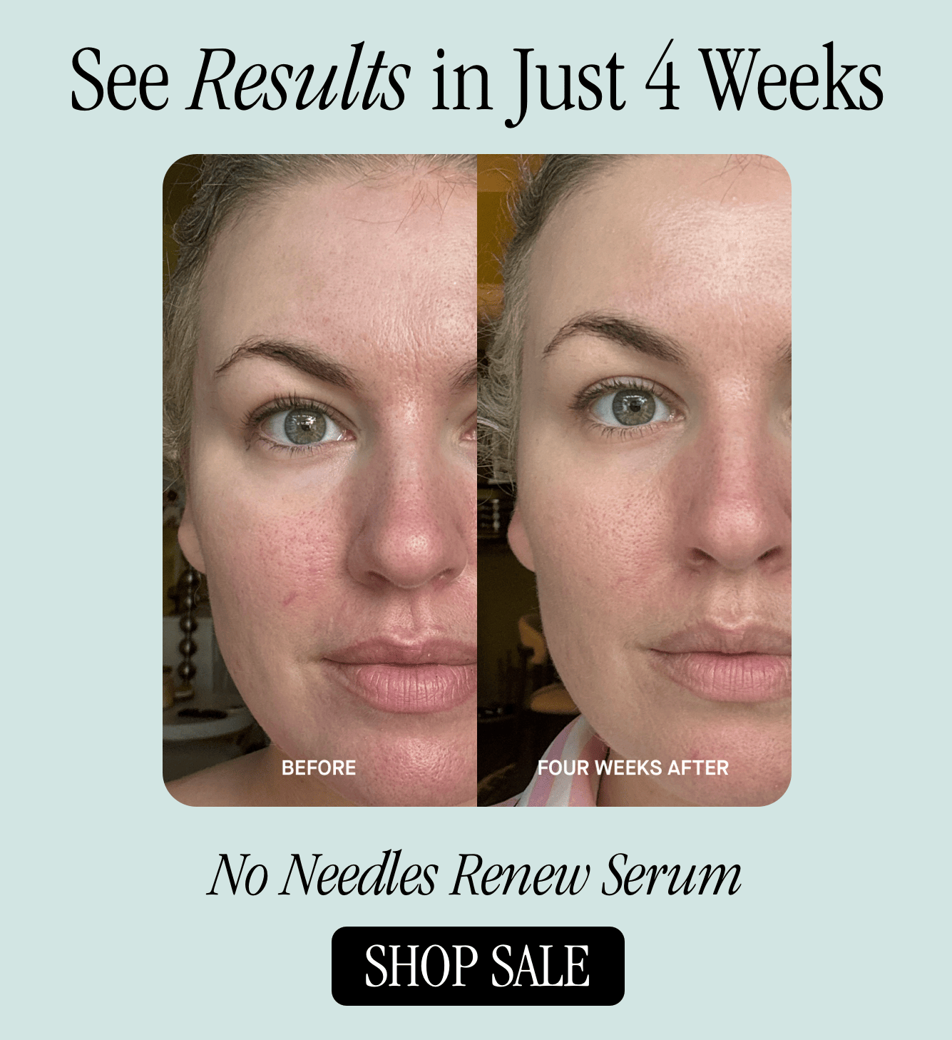 See Results in Just 4 Weeks