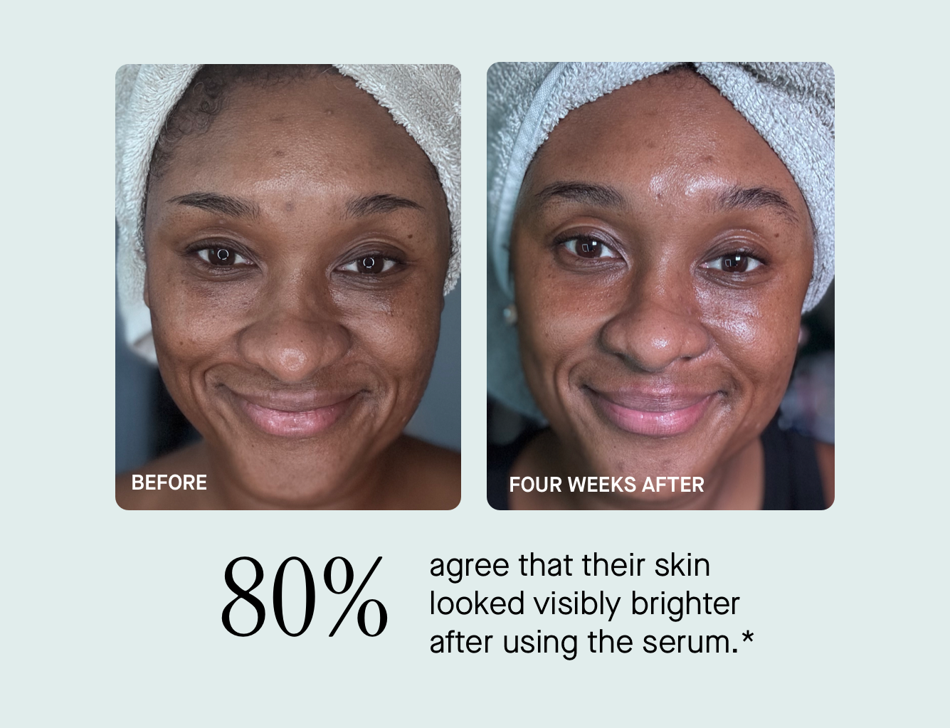 80% agree that their skin looked visibly brighter after using the serum.*