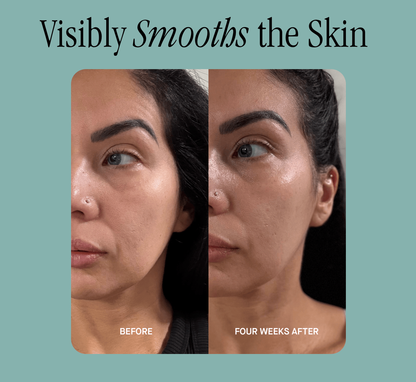 Visibly Smooths the Skin