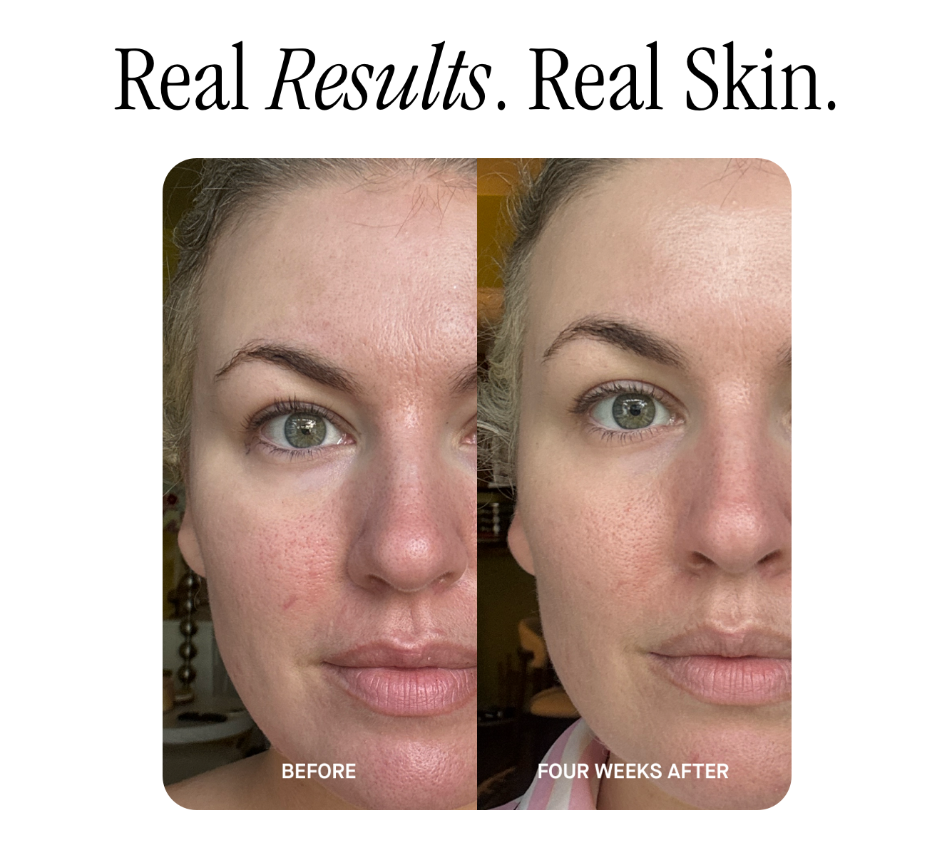 Real Results. Real Skin.