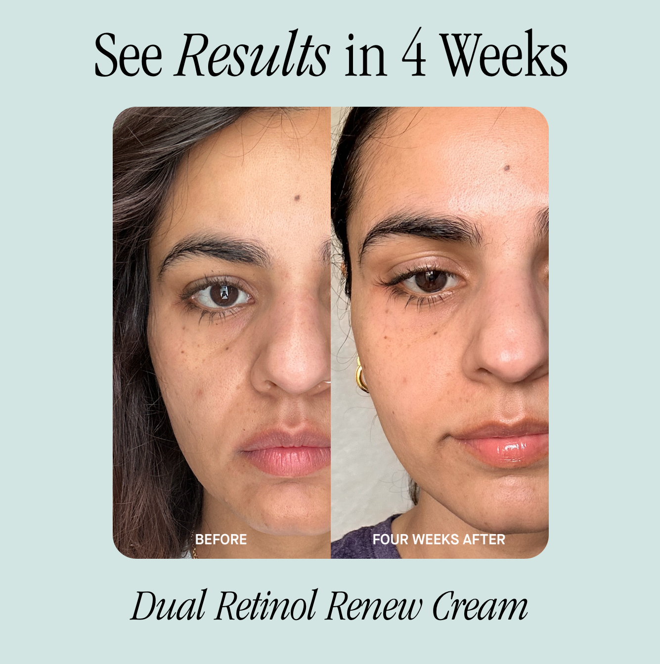 See Results in 4 Weeks 