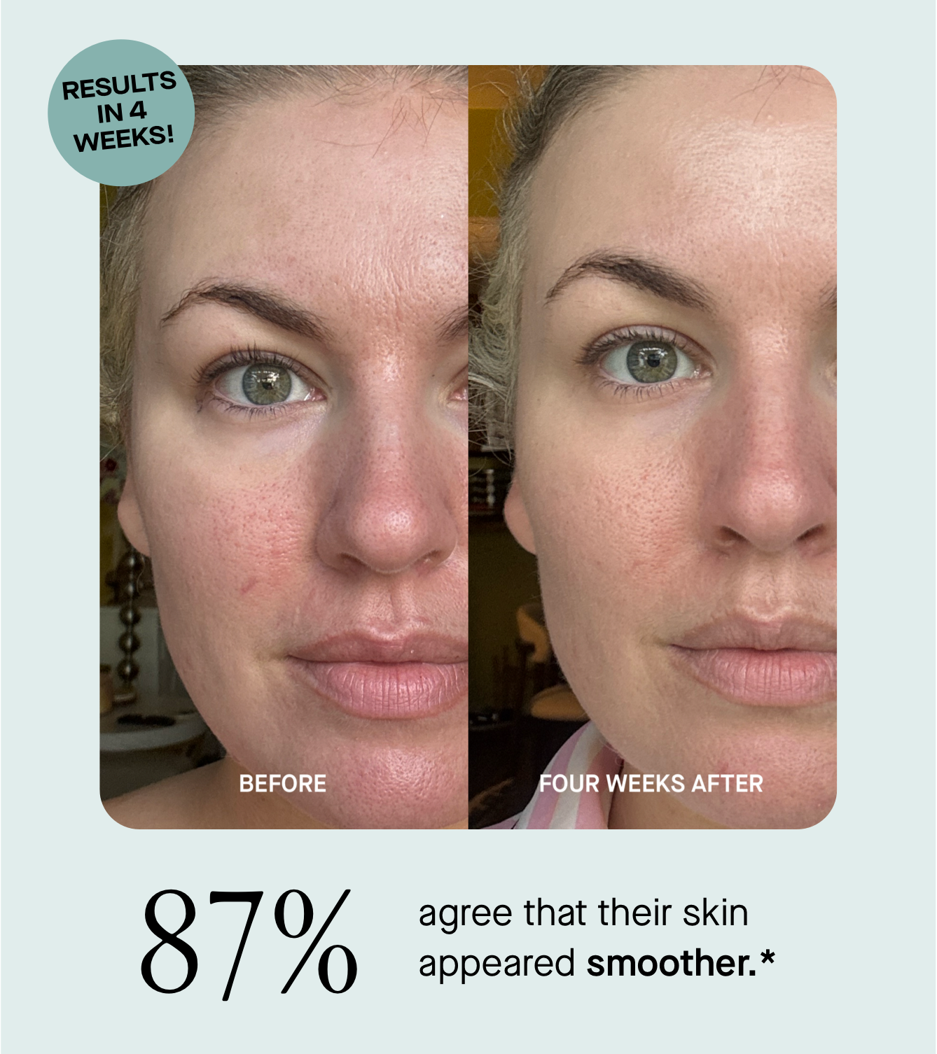 See Results in Just 4 Weeks