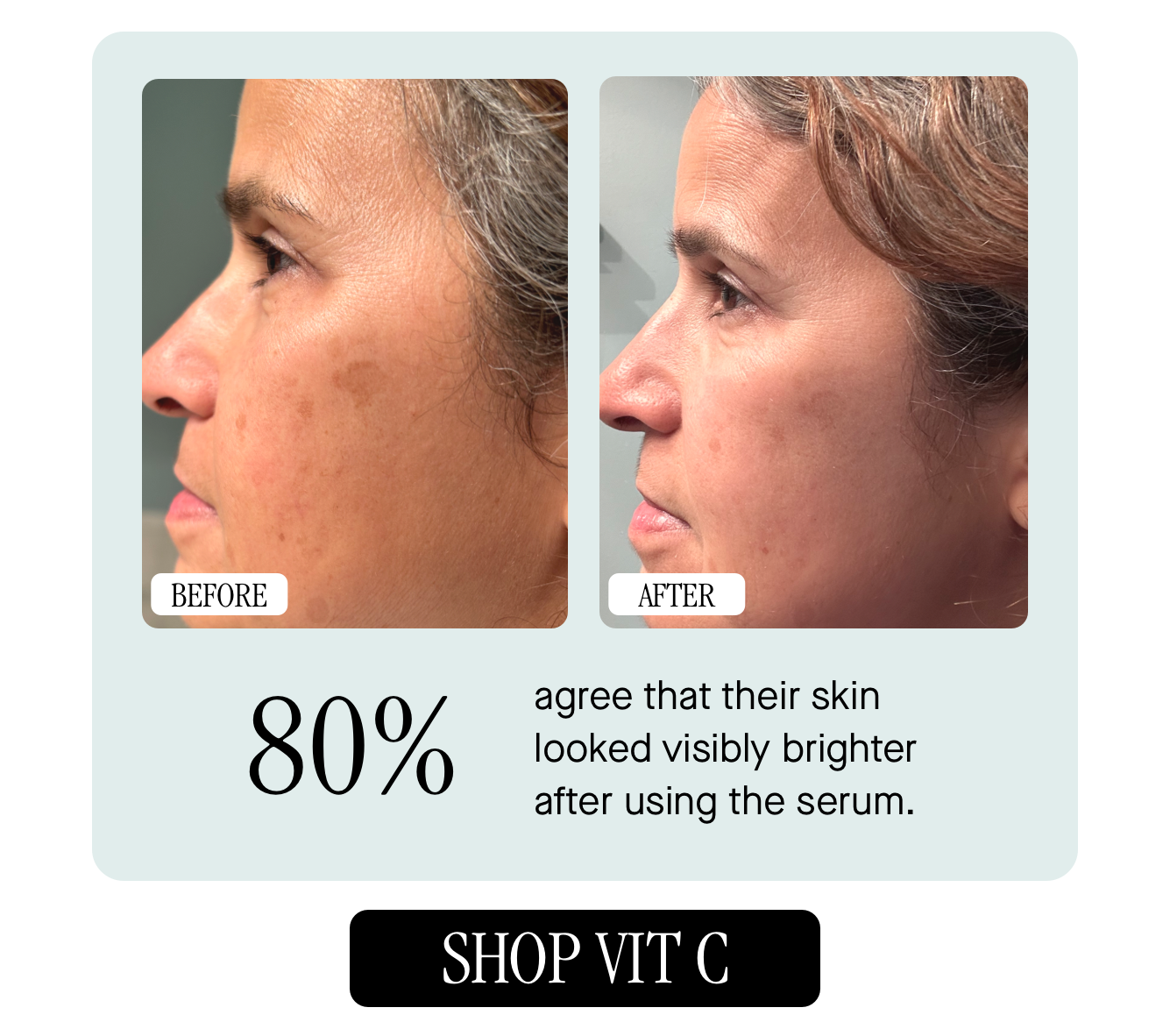 Before and After Photo  Before and After Photo