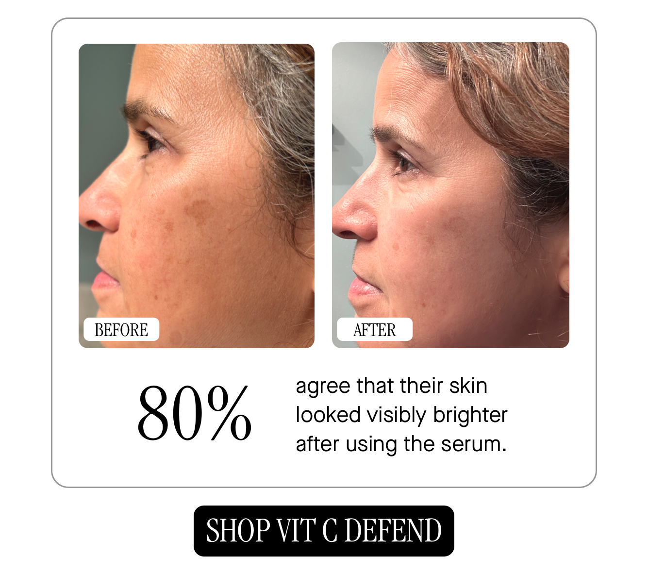 80% agree that their skin looked visibly brighter after using the serum. 80% agree that their skin looked visibly brighter after using the serum.