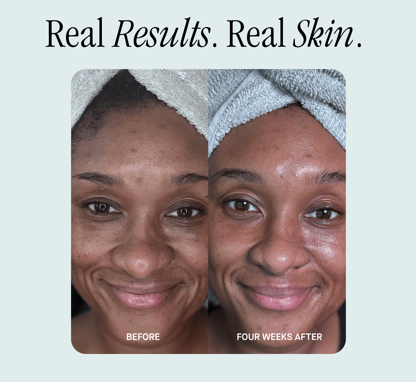 Real Results. Real Skin. 