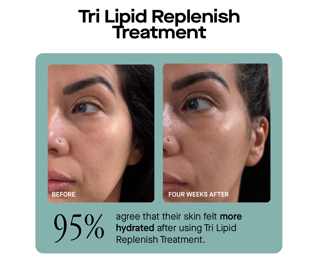 Tri Lipid Replenish Treatment